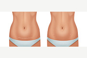 Scars Set, a Healthcare Illustration by Zonda (Thumbnail 7 of 13)