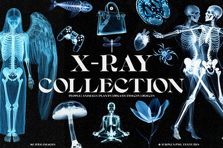 X-Ray Images Collection