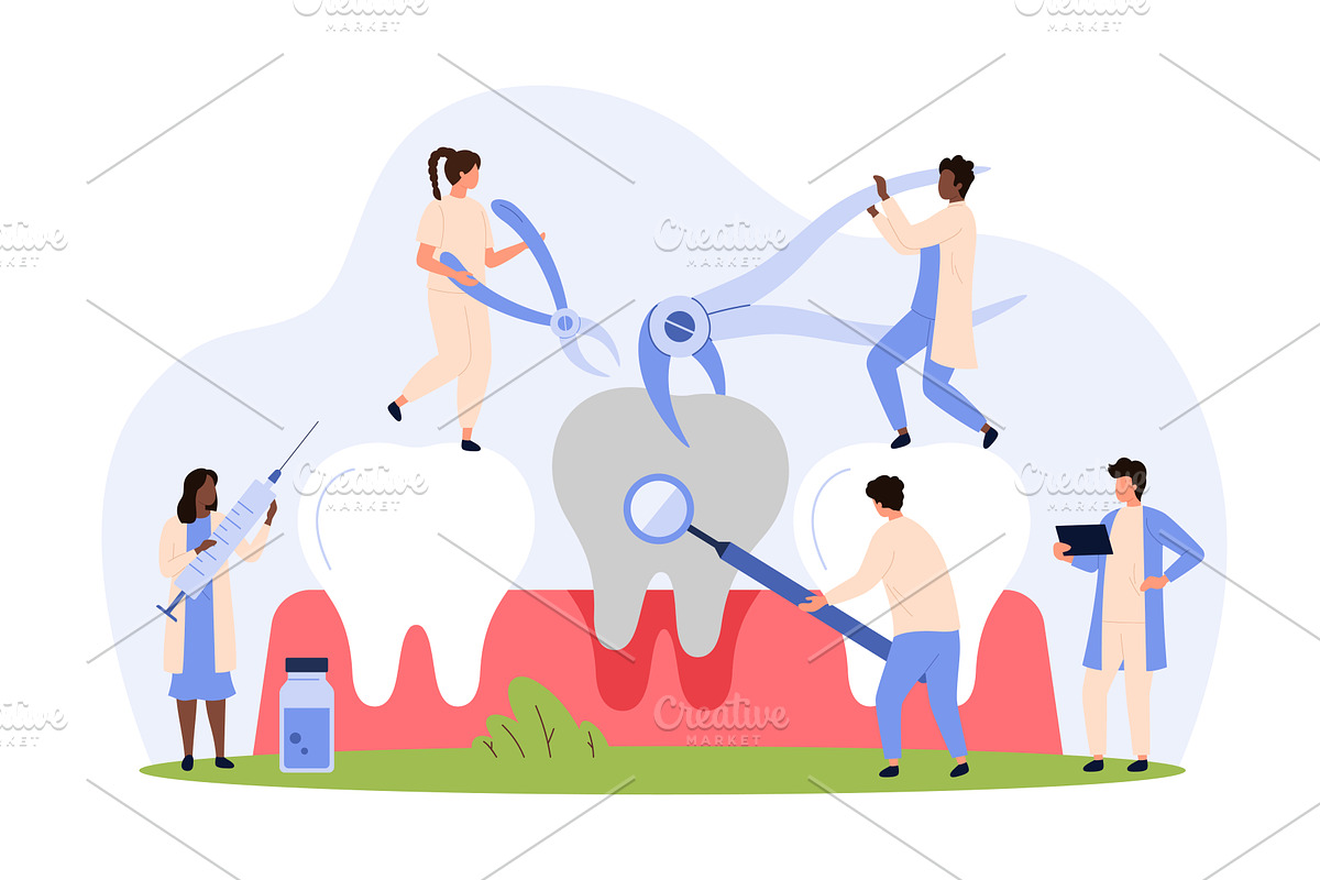 Tooth extraction procedure, removal, a Healthcare Illustration by Flashvector