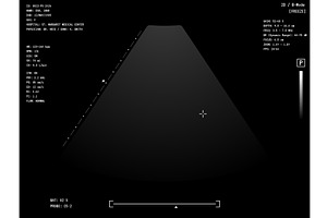 Medical Ultrasound Overlay, a Technology Illustration by SkyVectors