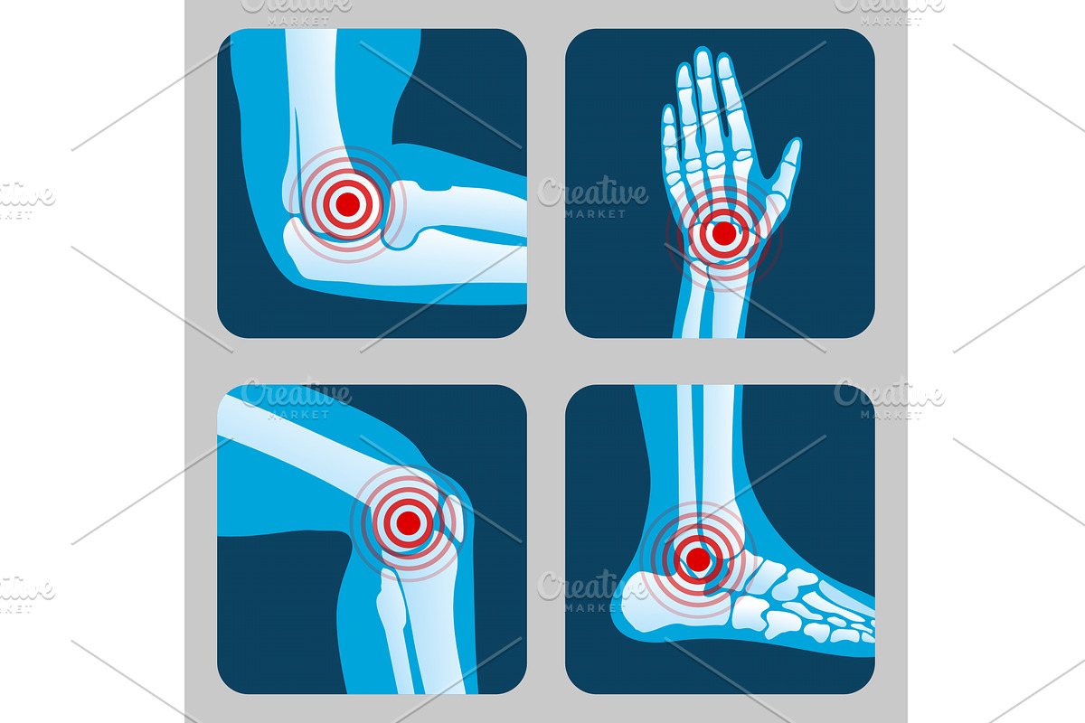 Human joints with pain rings, a Background Graphic by Valerie Bodnar