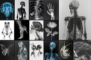 55 Immortal X-ray Print Posters, a Texture Graphic by NassyArt (Thumbnail 3 of 14)