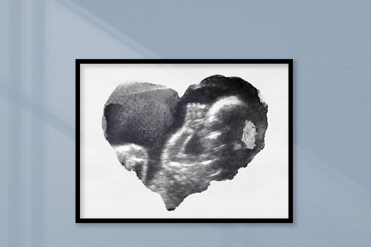 Watercolor ultrasound photomasks, a Layer Style Add-On by BrownLeopard (Photo 8 of 11)