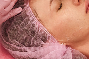 Dermal injection facial care woman hands filler, a Person Photo by Photo Drive Studio