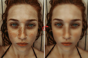 Skin Retouching Photoshop Action, an Action Add-On by MRI STUDIO (Thumbnail 4 of 13)