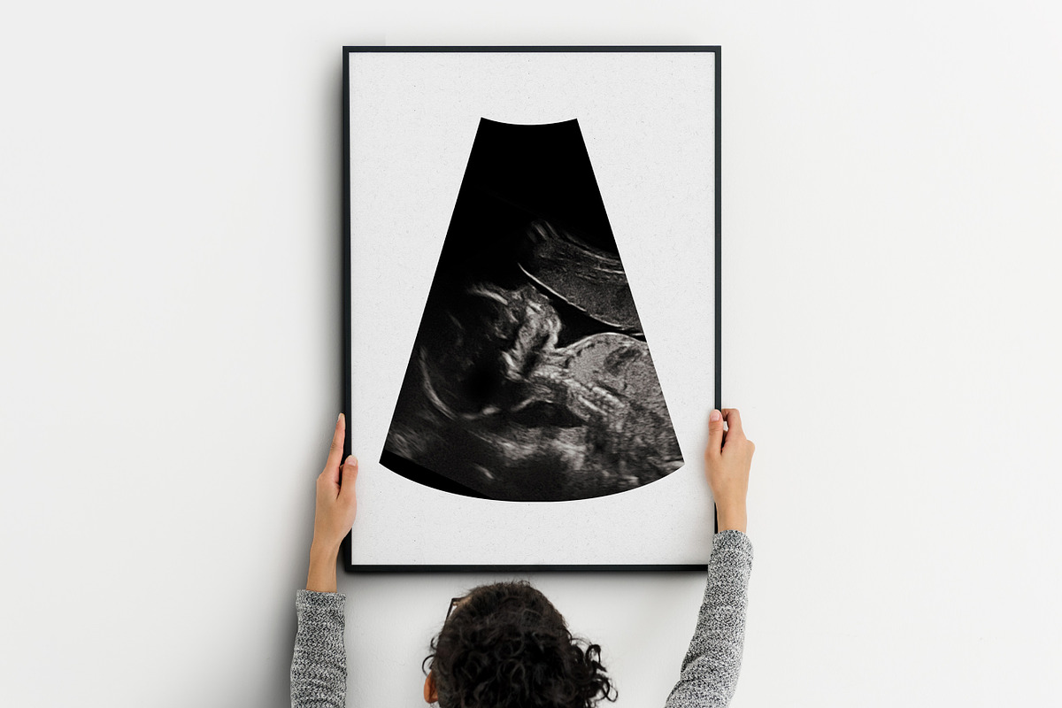 Watercolor ultrasound photomasks, a Layer Style Add-On by BrownLeopard (Photo 11 of 11)
