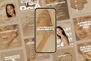 Aesthetic Skincare Insta Templates, a Social Media Template by Xenié Creative (Thumbnail 1 of 10)