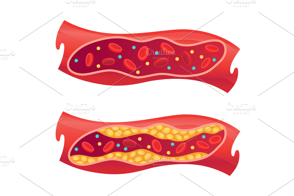 Types of cholesterol in human, an Object Illustration by Things for designers