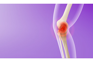 3d knee pain visualization, an Object Illustration by art PVP - market