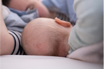 Bald spot on the back of the infant, a Person Photo by Koldunova