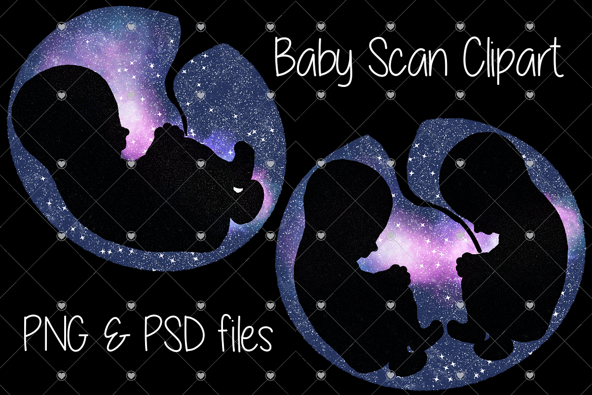 Baby, Scan, Rainbow baby, Pregnancy,, an Illustration by CommercialCliparts