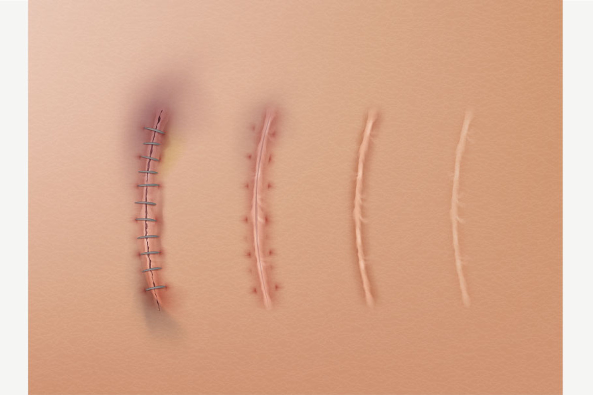 Scars Set, a Healthcare Illustration by Zonda (Photo 4 of 13)