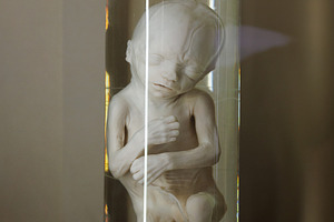 Human fetus 8 th month in glass container with formalin, a School & Education Photo by Bepslabor