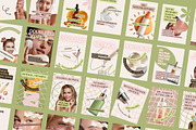 Skincare Instagram Carousel Canva, a Social Media Template by MOAROShop (Thumbnail 2 of 9)