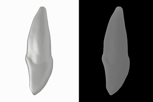 Human Upper Left Central Incisor