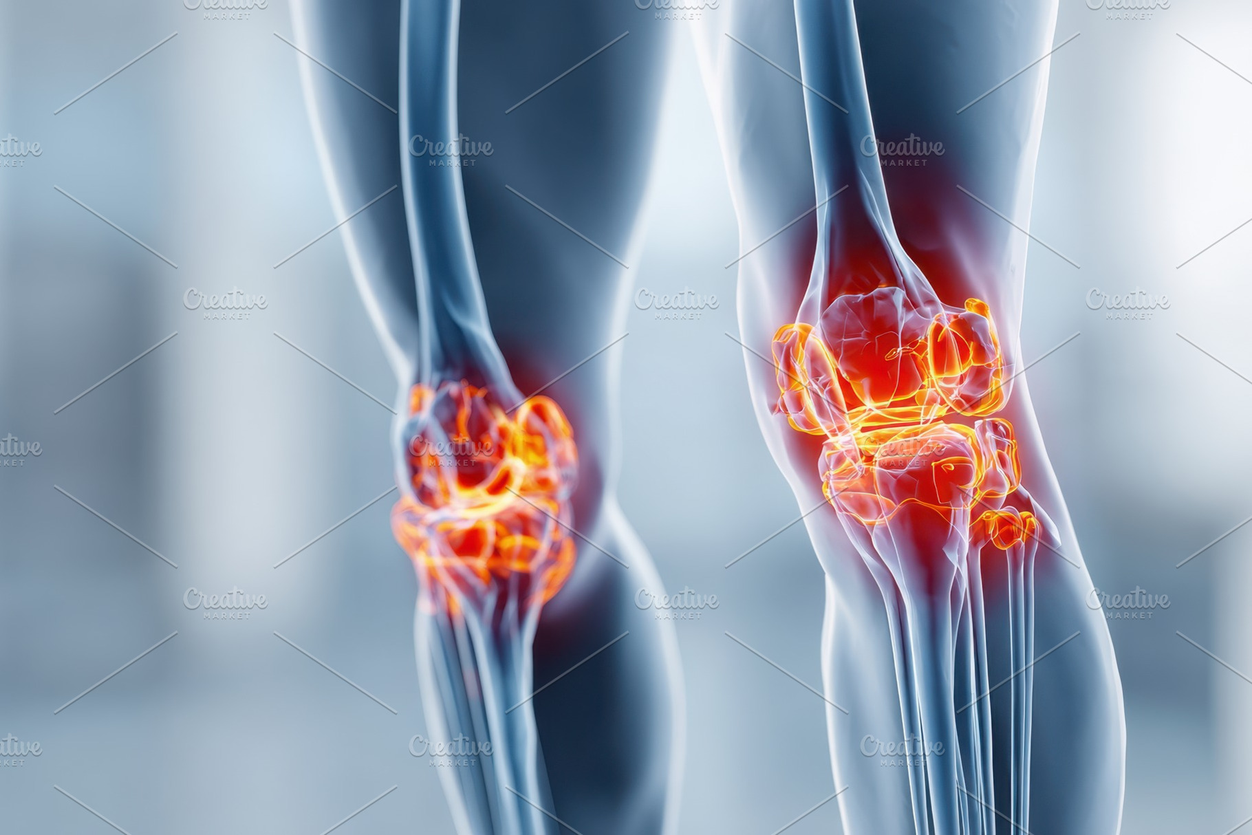 Illustration of human leg anatomy with glowing bones, a Health & Medical Photo by AlyaAnd