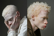 66 Albino persons, a Person Photo by Handmadefont (Thumbnail 10 of 10)