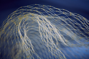 Abstract tunnel effect with yellow nylon mesh on dark blue background. Curved s, an Abstract Photo by Rohan Photography