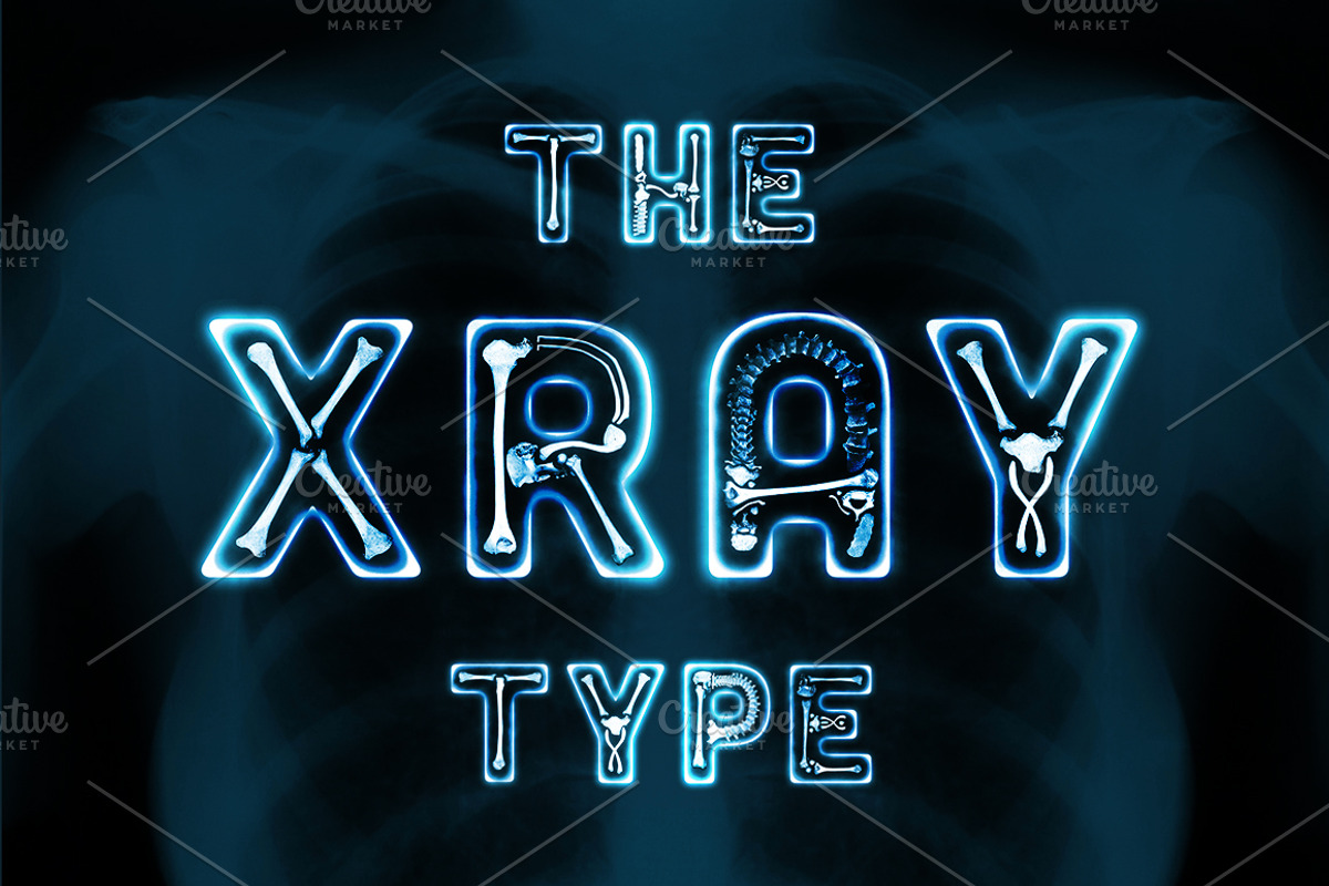 The X-Ray Type
