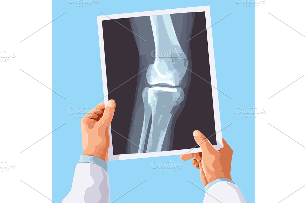 Hands hold x ray. Doctor Hand, an Object Illustration by Stock-Smart-Start