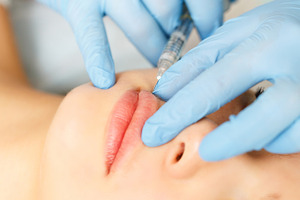 Subcutaneous injection lips featuring background, medical, and woman, a Health & Medical Photo by Elena Vagengeim