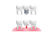 Dental Care Vector Icons set, an Emoji Icon by Rodionoff (Thumbnail 2 of 6)