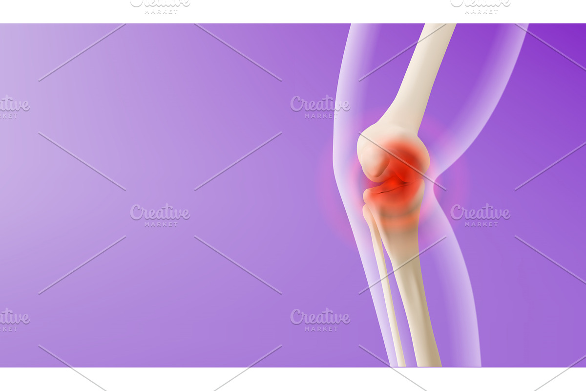 3d knee pain visualization, an Object Illustration by art PVP - market