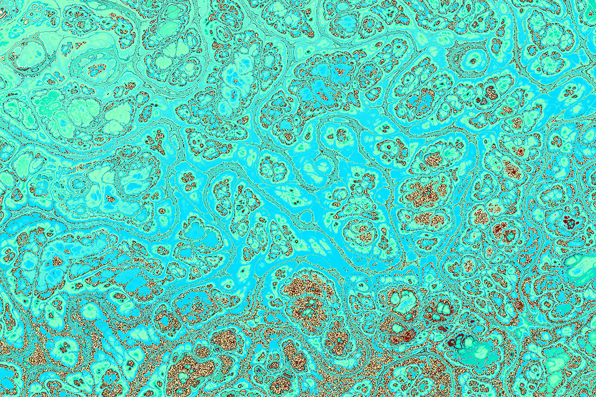 20 turquoise textures 64 Megapixel, a Texture Graphic by tkdesign (Photo 18 of 20)