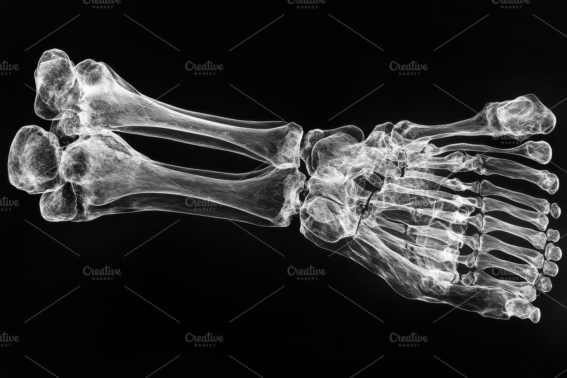 Detailed X-ray view of a human foot, a Photo by Tanuart