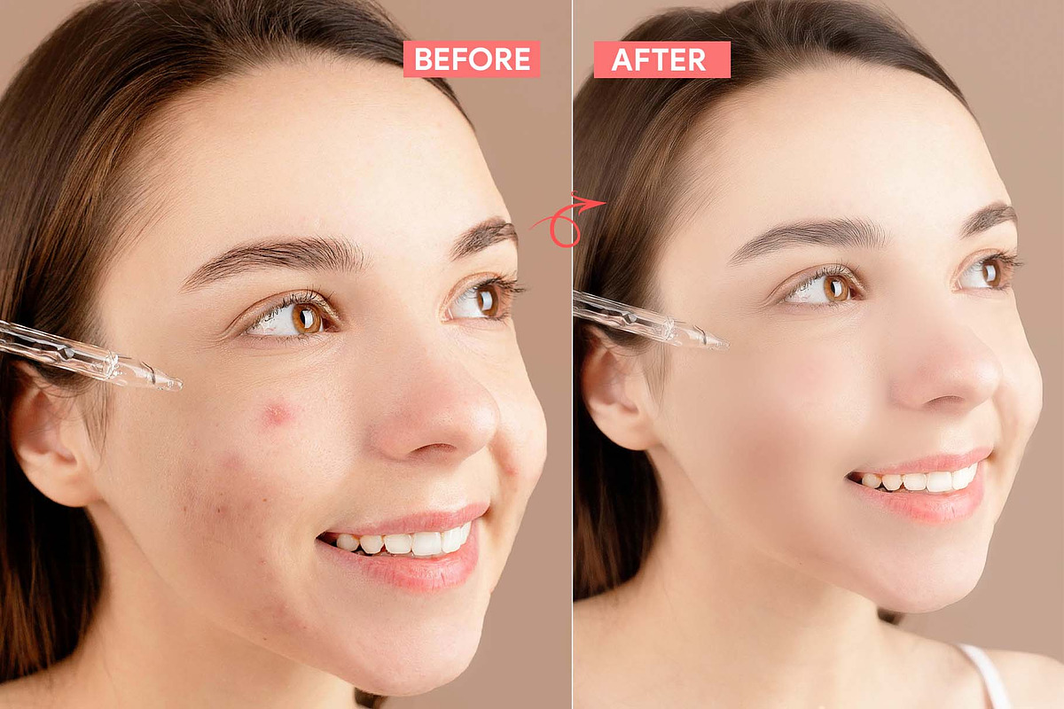Smooth Skin Pro Photoshop Action, an Action Add-On by MRI STUDIO (Photo 3 of 8)