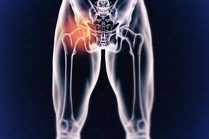 When inflammation strikes!, a Photo by Peopleimages.com