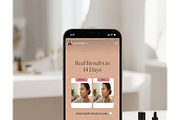 Aesthetic Skincare Social Media Kit, a Social Media Template by FusionadCreates (Thumbnail 3 of 7)