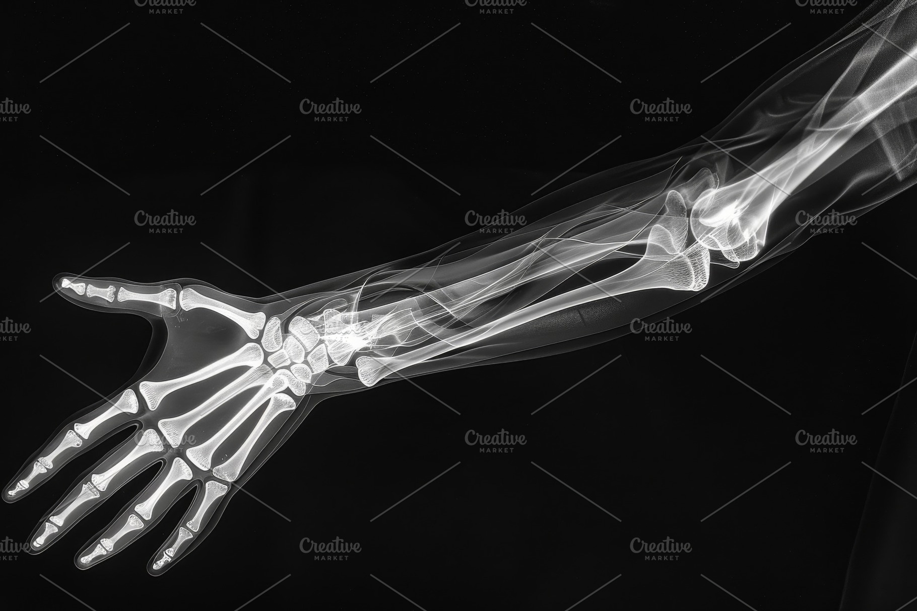A detailed X-ray illustrates the ske, a Photo by Tanuart