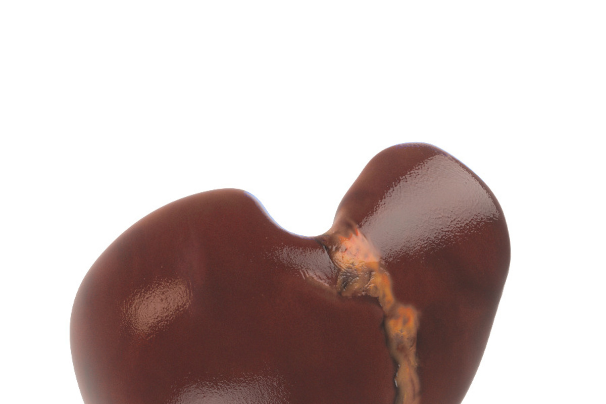 Human liver, a Characters & Person 3D Model by konstantin.ermolaev (Photo 3 of 6)