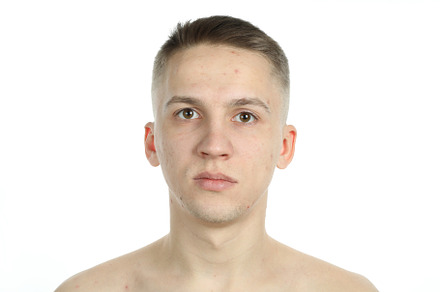Young man with problem face skin isolated on white background, a Person Photo by AtlasStudio