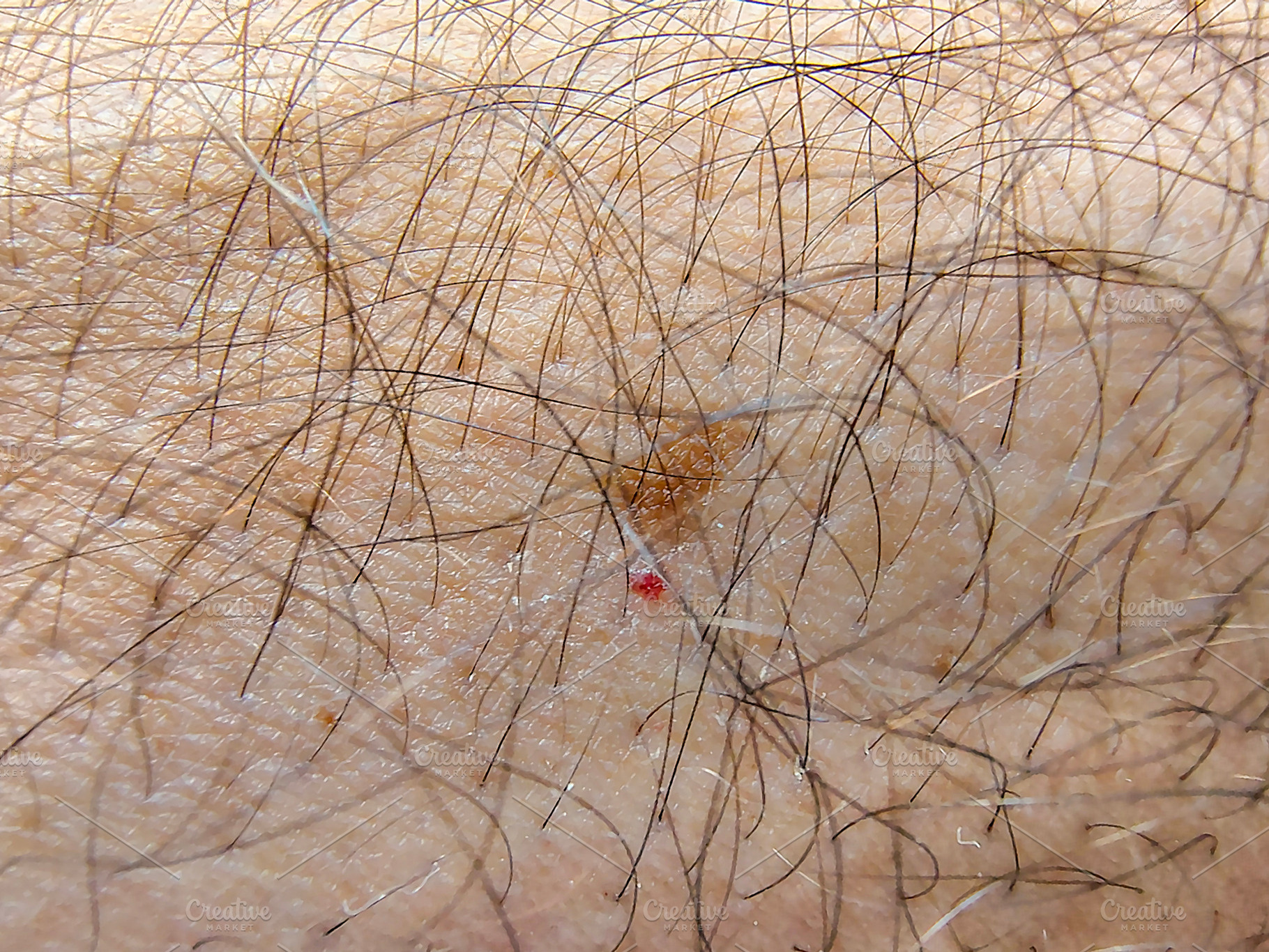 Persons arm detail showing skin and hair texture, a Health & Medical Photo by DanFLCreativo