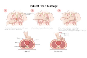 Step-by-Step Guide to Indirect Heart, a Healthcare Illustration by AlexArt