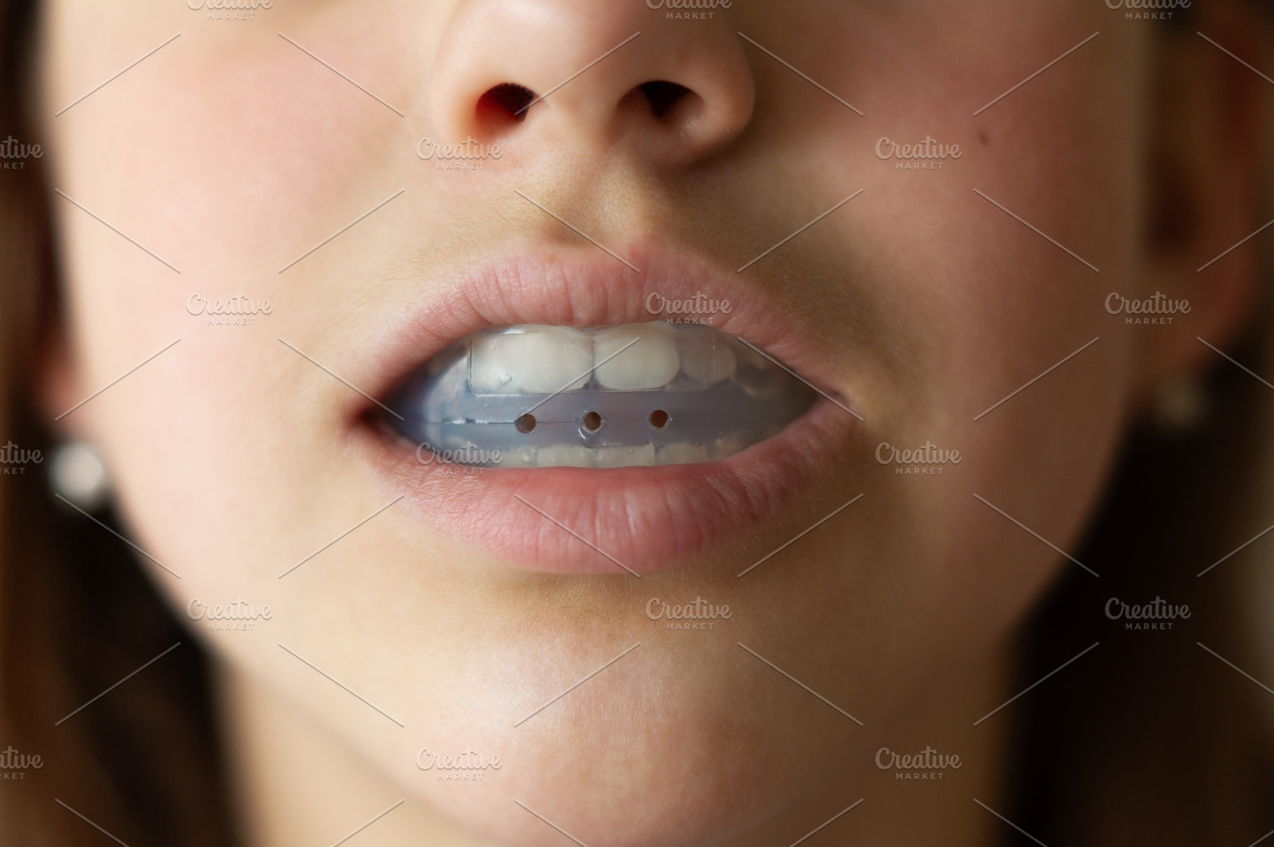 Mouth guard for teeth, a Health & Medical Photo by Nastya_Velko