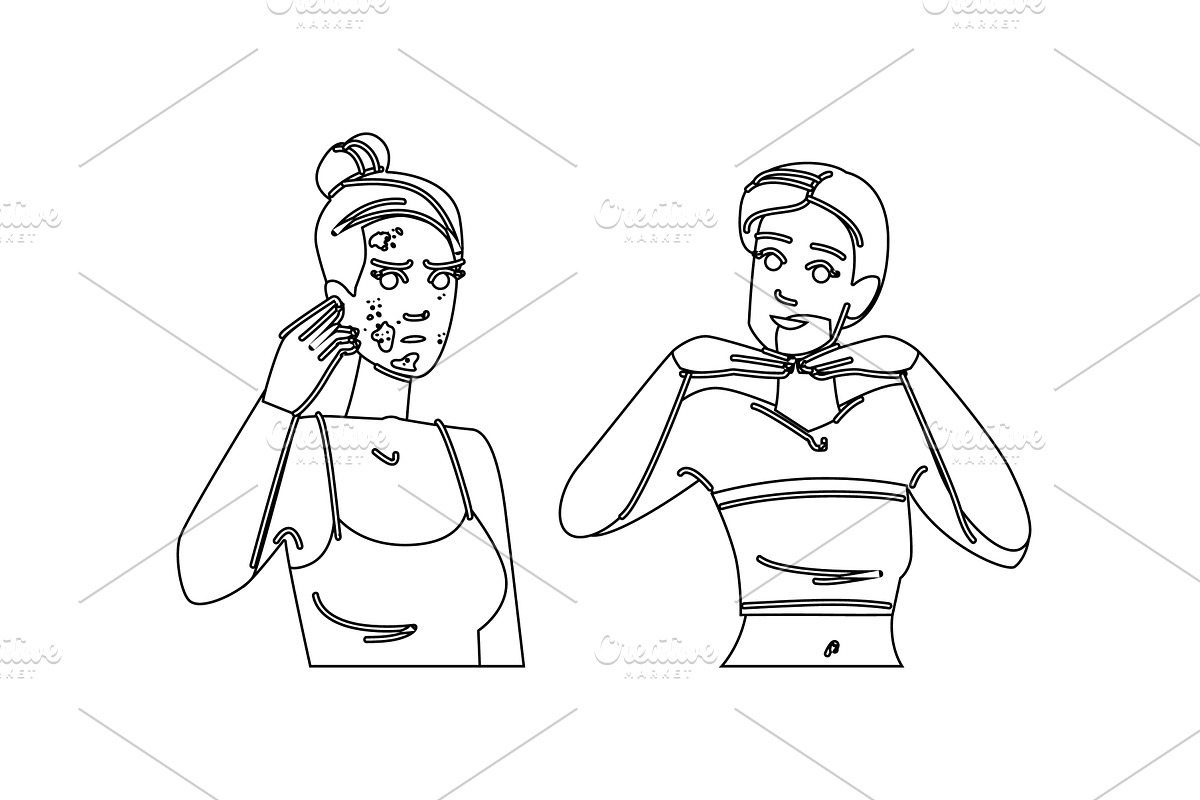 transformation acne before after, a Person Illustration by pikepicture