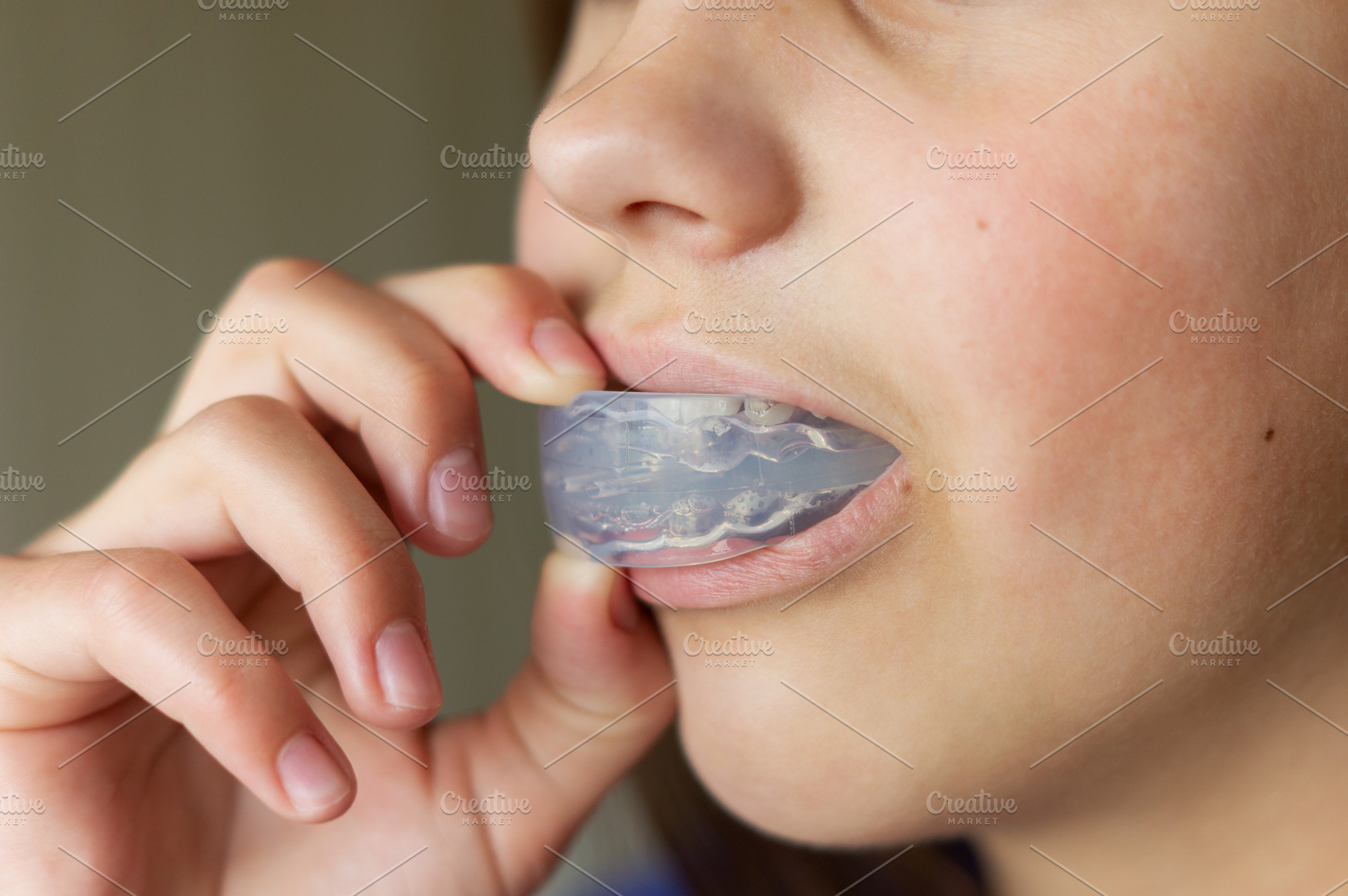 Orthodontic mouth guard for teeth, a Health & Medical Photo by Nastya_Velko