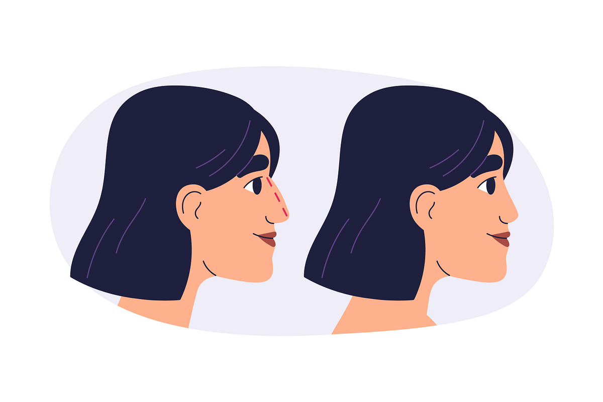 Plastic surgery in beauty clinic set, a Healthcare Illustration by Good Studio (Photo 3 of 12)