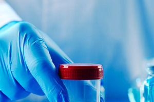 man in a laboratory with a container with semen, a Photo by Nito