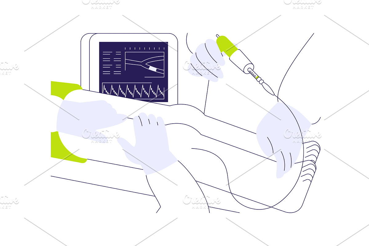 Vascular surgery abstract concept, a Healthcare Illustration by Visual Generation