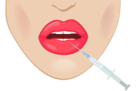Lips Augmentation