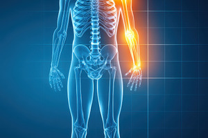 Digital Illustration of Human Skeleton with Highlighted Arm Joint, a Health & Medical Photo by AlyaAnd