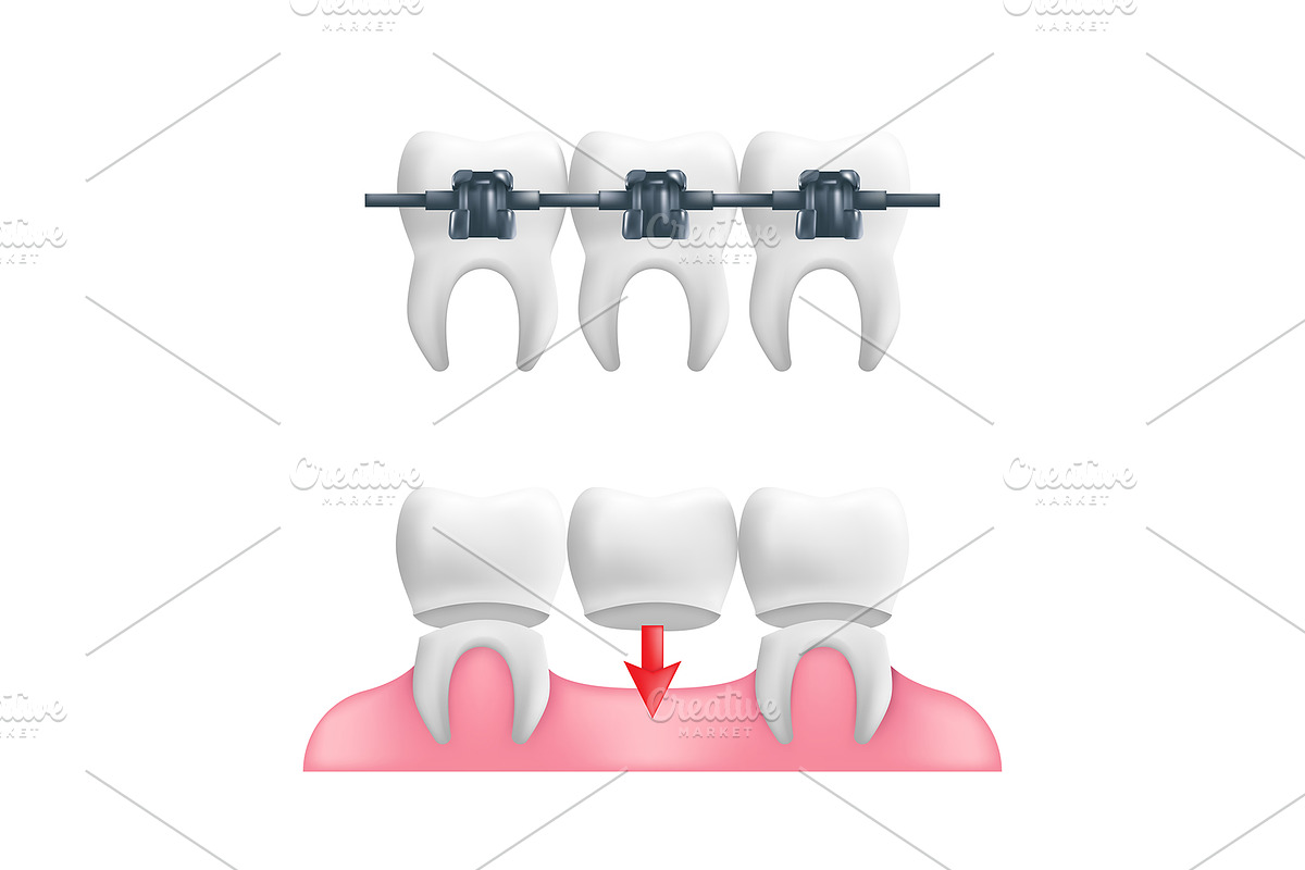 Dental Care Vector Icons set, an Emoji Icon by Rodionoff (Photo 4 of 6)