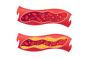 Types of cholesterol in human, an Object Illustration by Things for designers