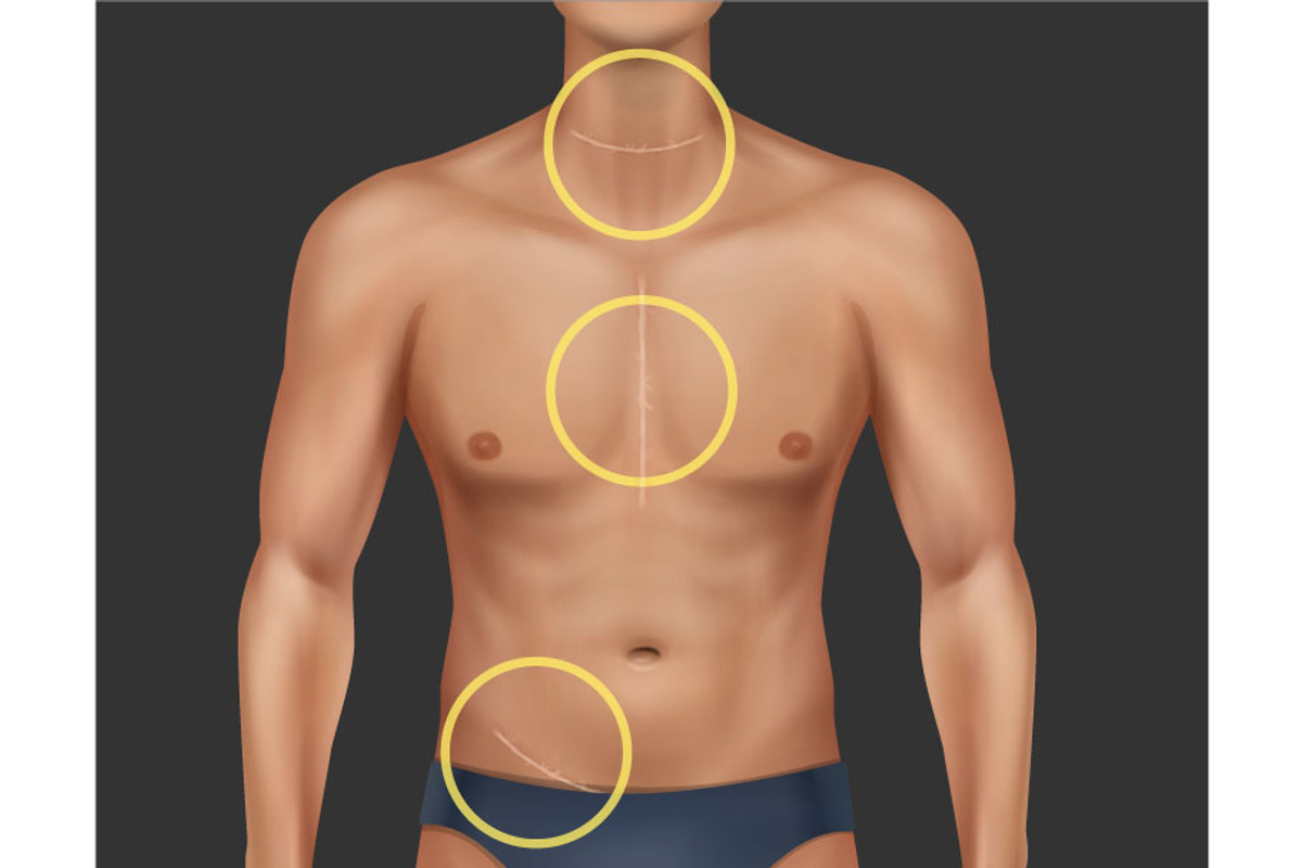 Scars Set, a Healthcare Illustration by Zonda (Photo 9 of 13)