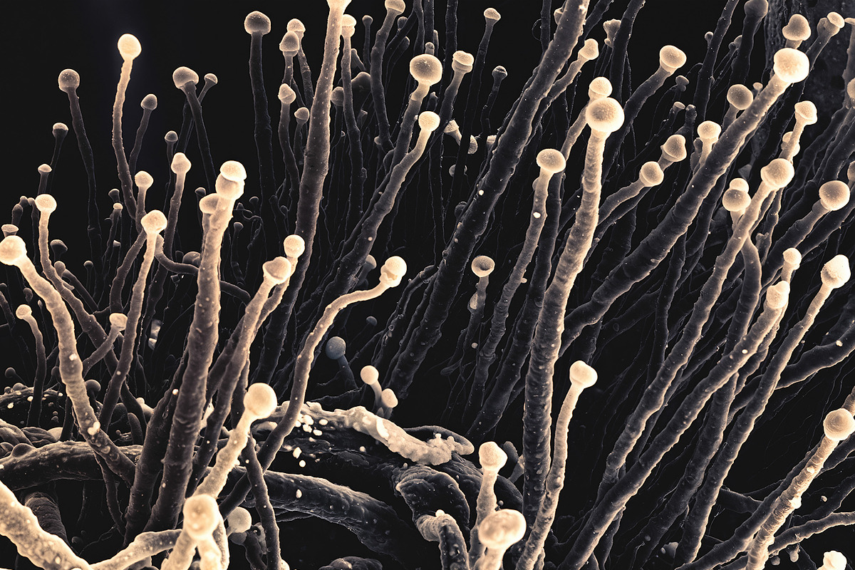 72 Microscopic Fungi Backgrounds, a Background Graphic by h.utomo (Photo 5 of 72)