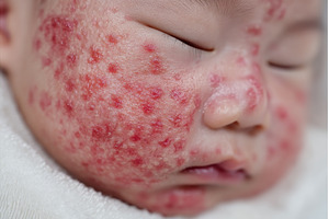 A newborn baby's face is shown close, a Person Photo by ZinetroN